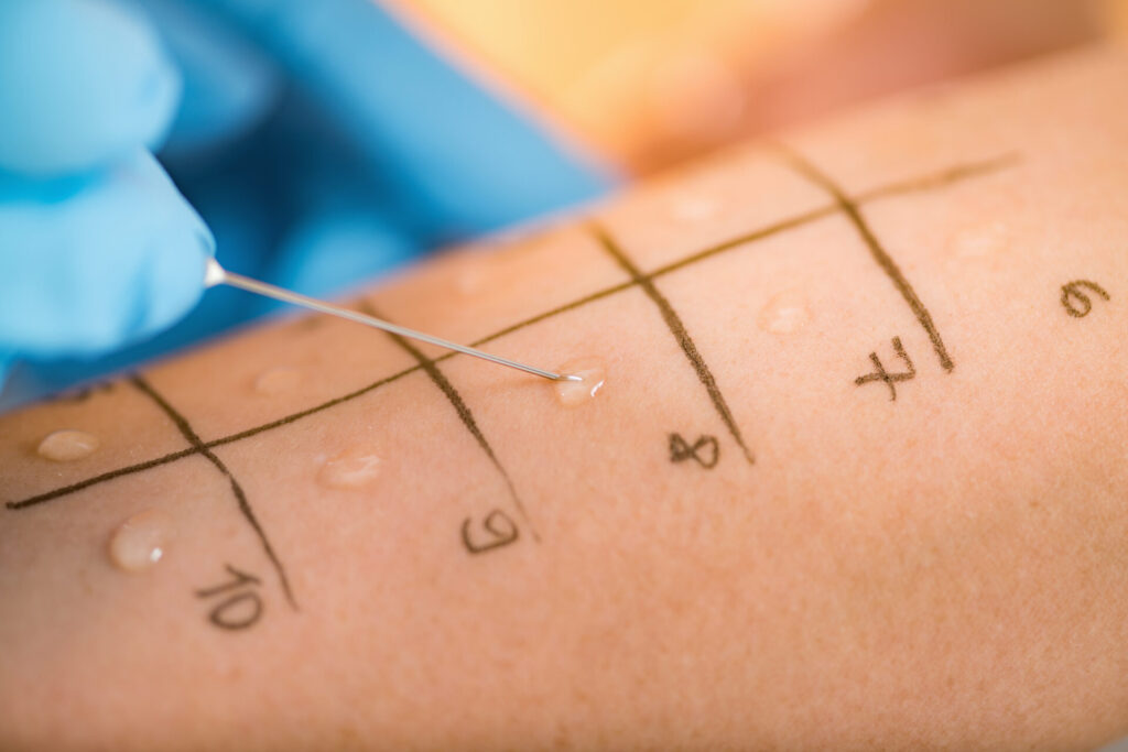 Pollen Allergy Test: What to Expect, Cost & Next Steps