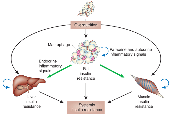 Stress Insulin Resistance: How Stress Raises Sugar