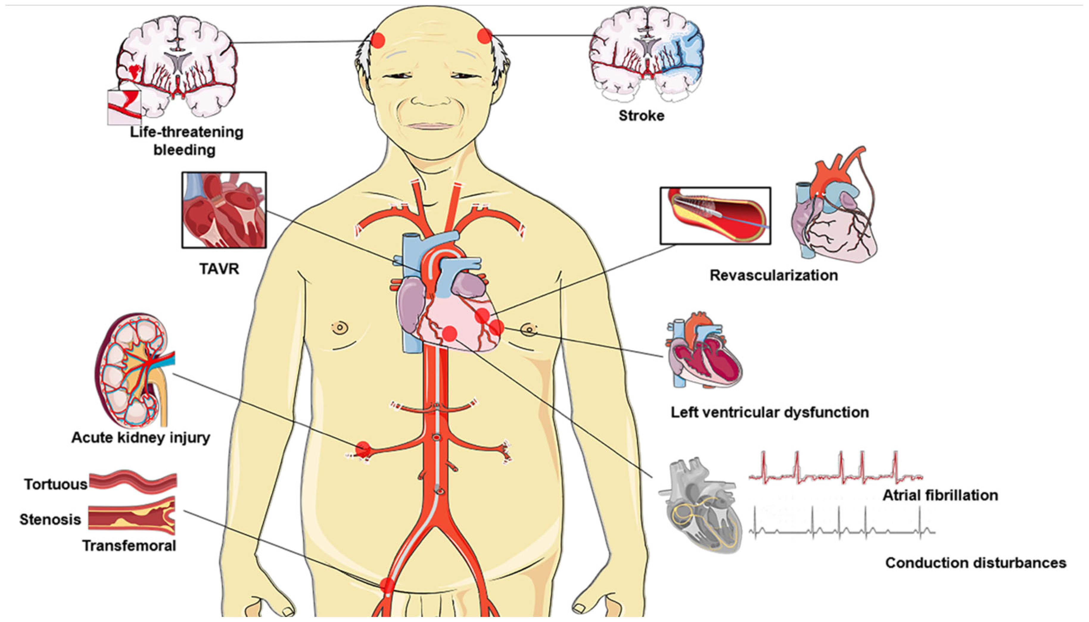 TAVR in 80‑Year‑Olds: What You Need to Know Today