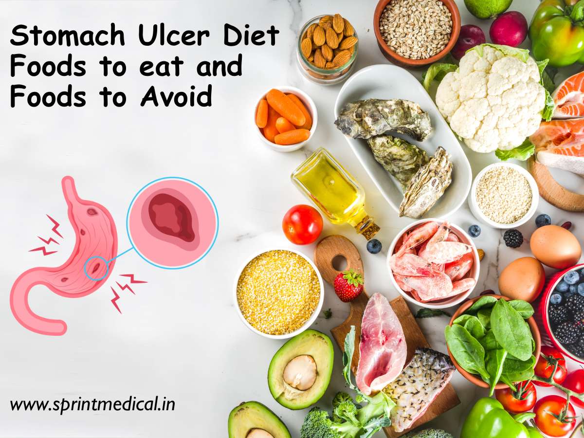 Ulcer Diet Tips: Best Foods, What to Avoid & 7-Day Plan