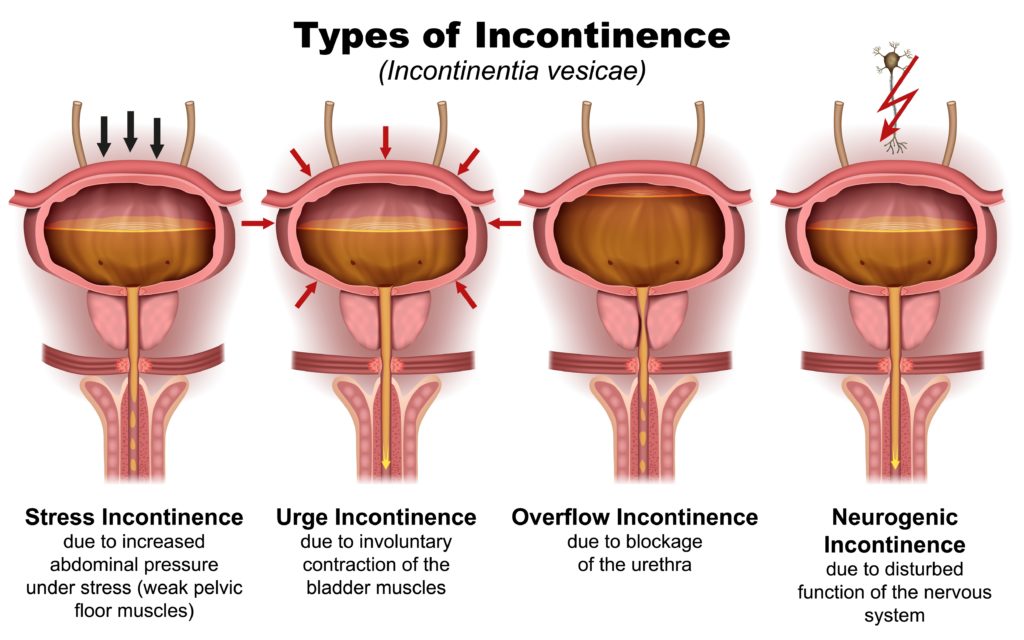 Urinary Tract Stress: How Anxiety Impacts Your Bladder Health
