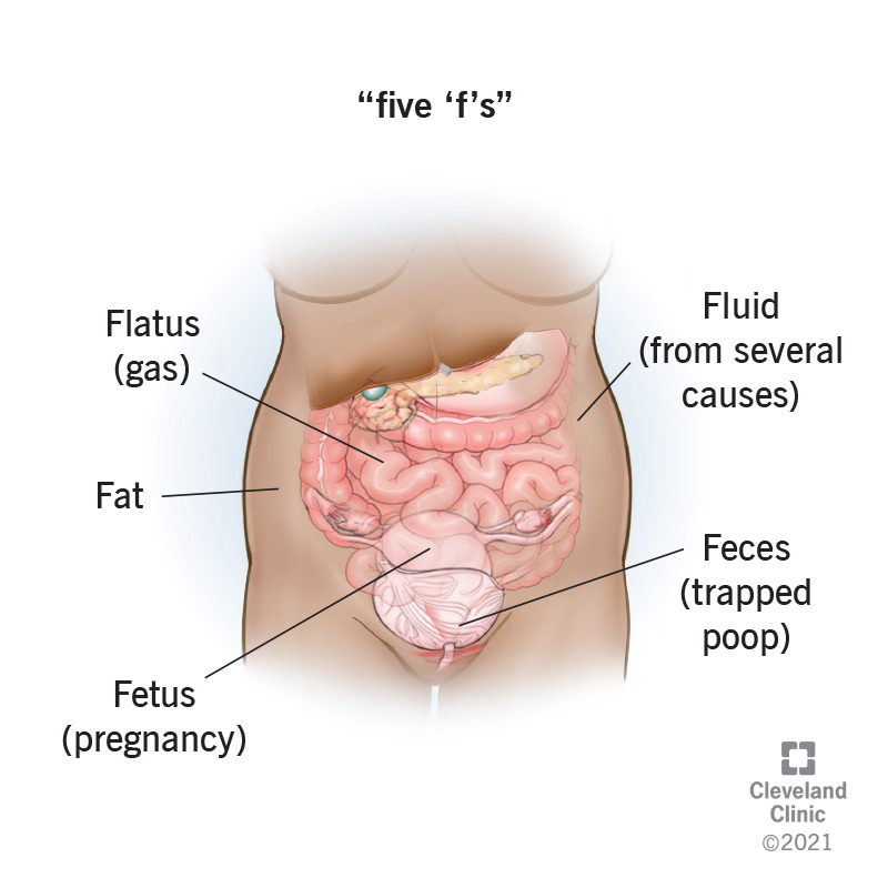 Abdominal Bloating: Causes, Symptoms & Fast Relief Tips
