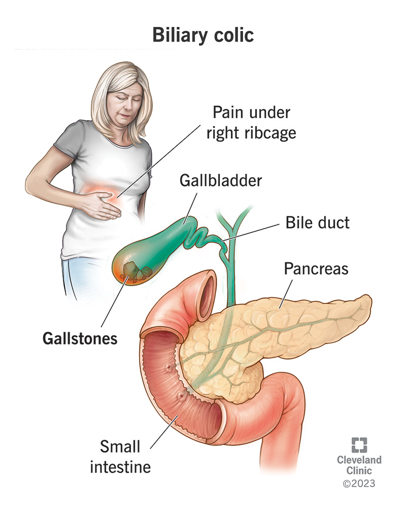 Abdominal Pain Gallbladder: Fast Relief, When to Call
