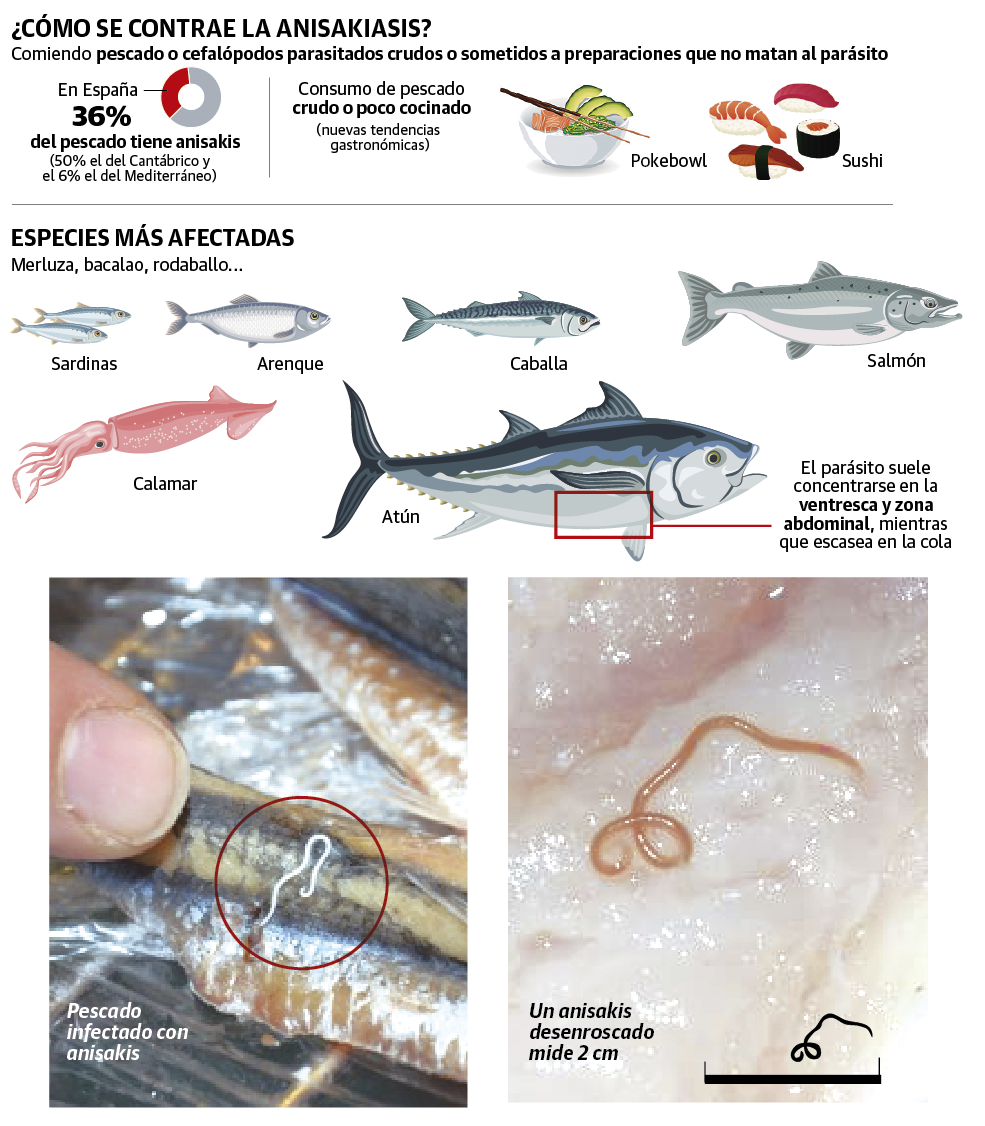 Anisakiasis Prevention: Quick Tips to Stay Safe While Eating Raw Fish