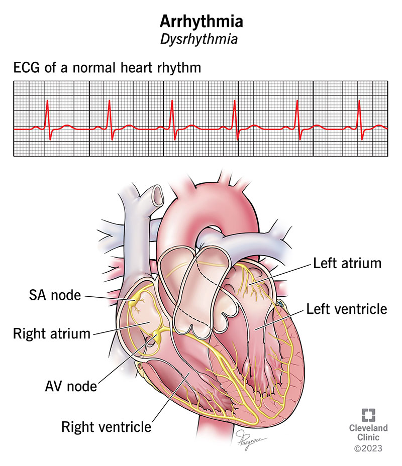 Arrhythmia Side Effects: What They Mean for You