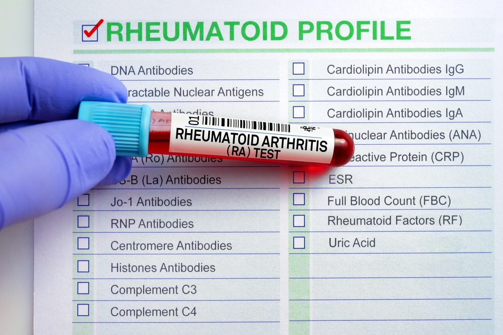 Arthritis Tests: What They Are, How They Help