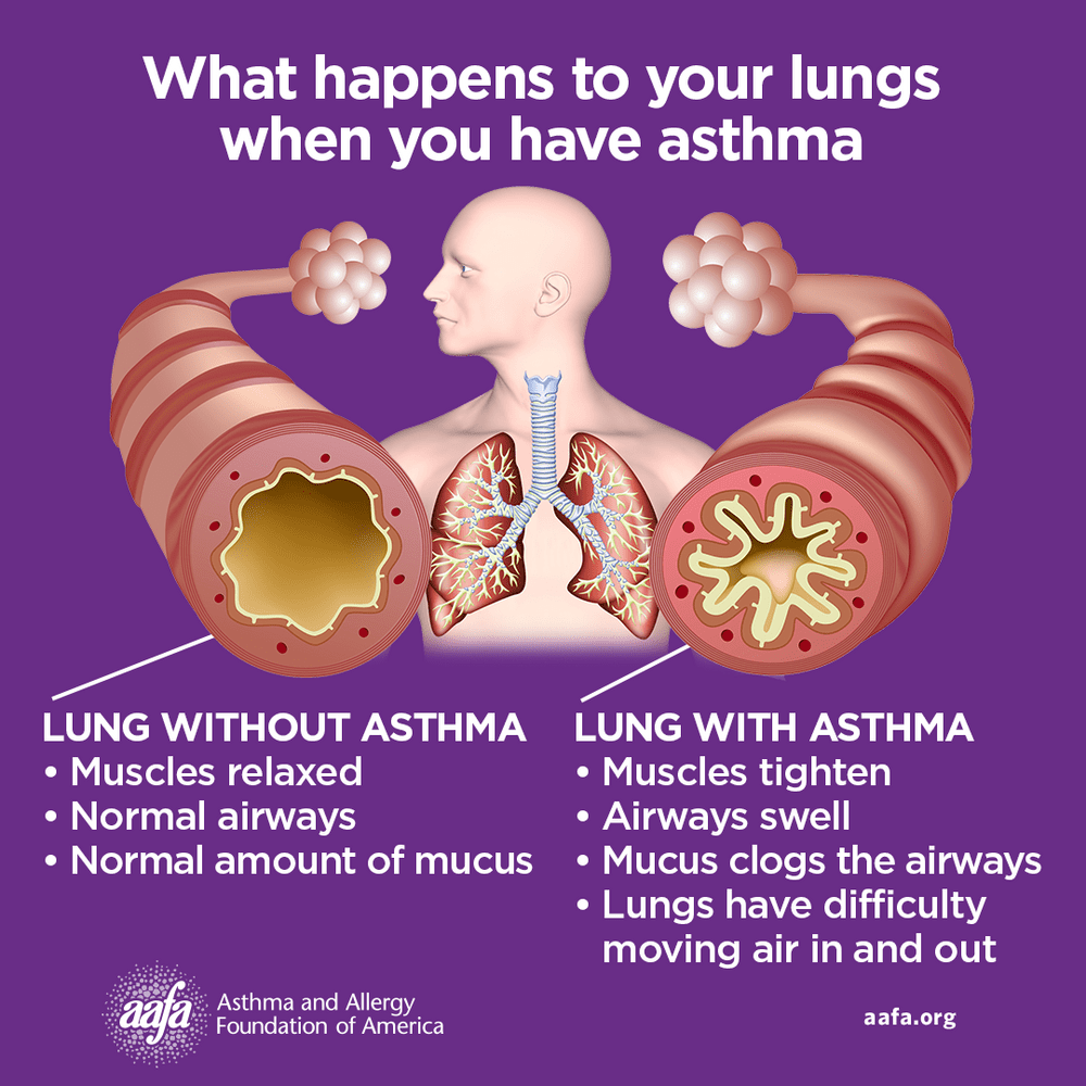 Asthma Stomach Pain: Why It Happens & How to Get Relief