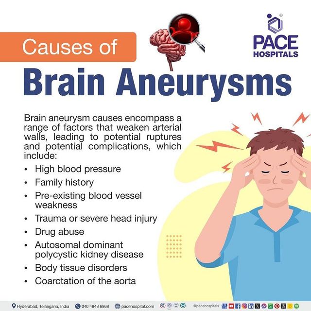 Brain Aneurysm Risk Factors: How They Raise Your Chance