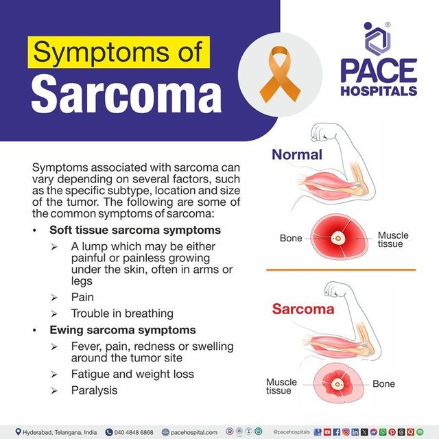 Childhood Sarcoma Diagnosis: A Parent’s Essential Guide