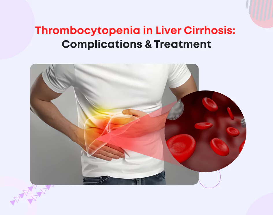 Cirrhosis Platelet Treatment: Boost Your Count Safely