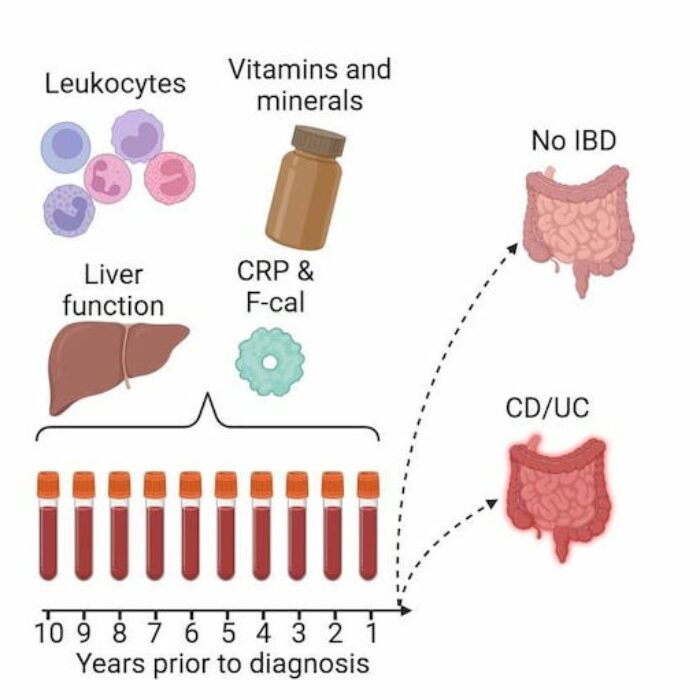 Colitis Biomarker Test: What It Is and Why It Matters