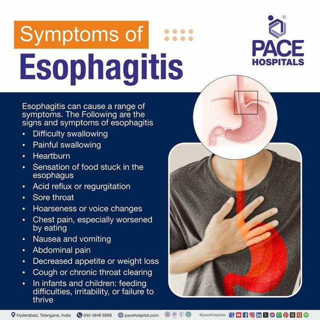 Esophagitis Symptoms – What You Feel & Why It Matters