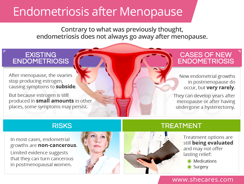 Postmenopausal Endometriosis: Symptoms & Treatment