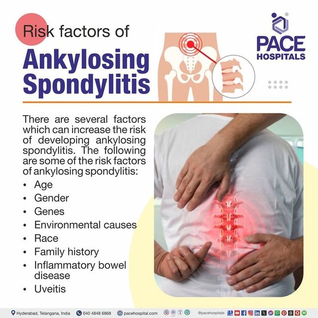 Ankylosing Spondylitis Risk: Key Facts & How to Act