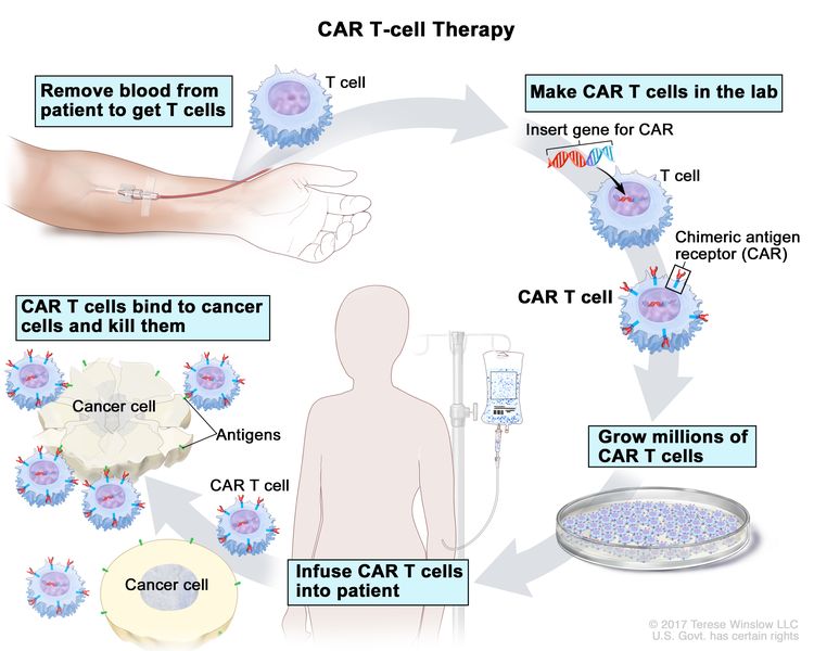 B cell cancer treatment: options, risks and hope