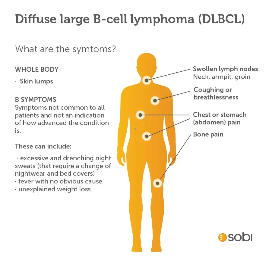 B Cell Lymphoma: Symptoms, Treatment & Survival