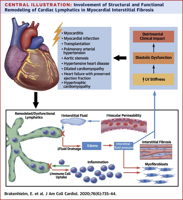 Effective Cardiac Edema Treatment: Quick Relief Guide