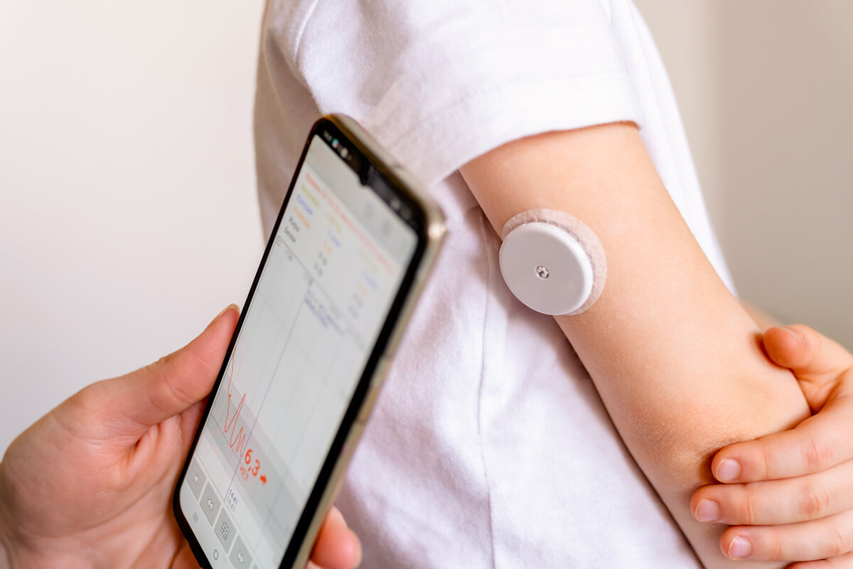 CGM for Diabetes: Benefits, Choices & Best Devices