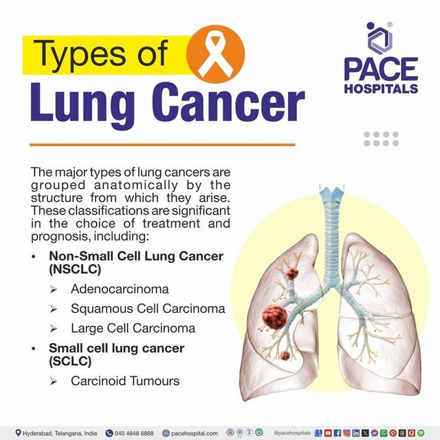 Chest Tumor Types – What You Need to Know Today