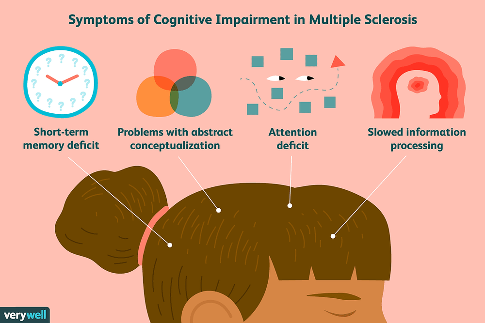 Cognitive Symptoms MS – What to Expect & Manage