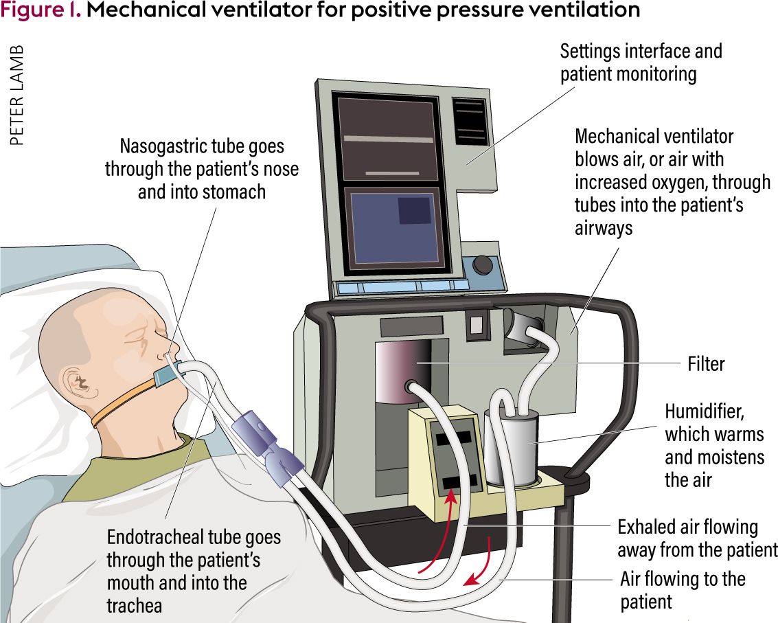 COPD Ventilator Types: What You Need to Know Today