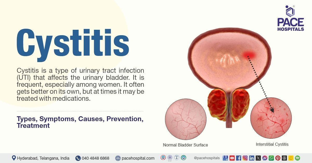 cystitis vs normal bladder: what’s the real difference?