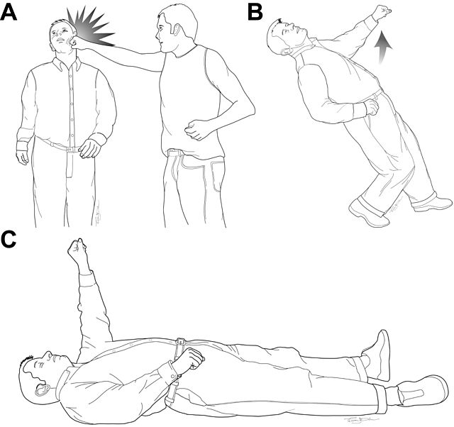 Fencing Response vs Decorticate: What’s the Difference?