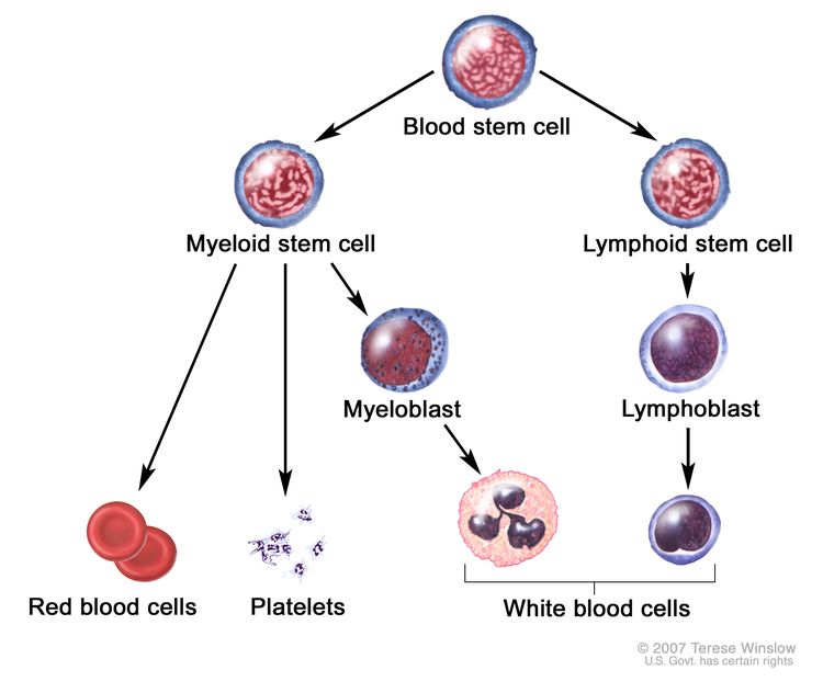 Final Stages of Acute Myeloid Leukemia: What to Expect