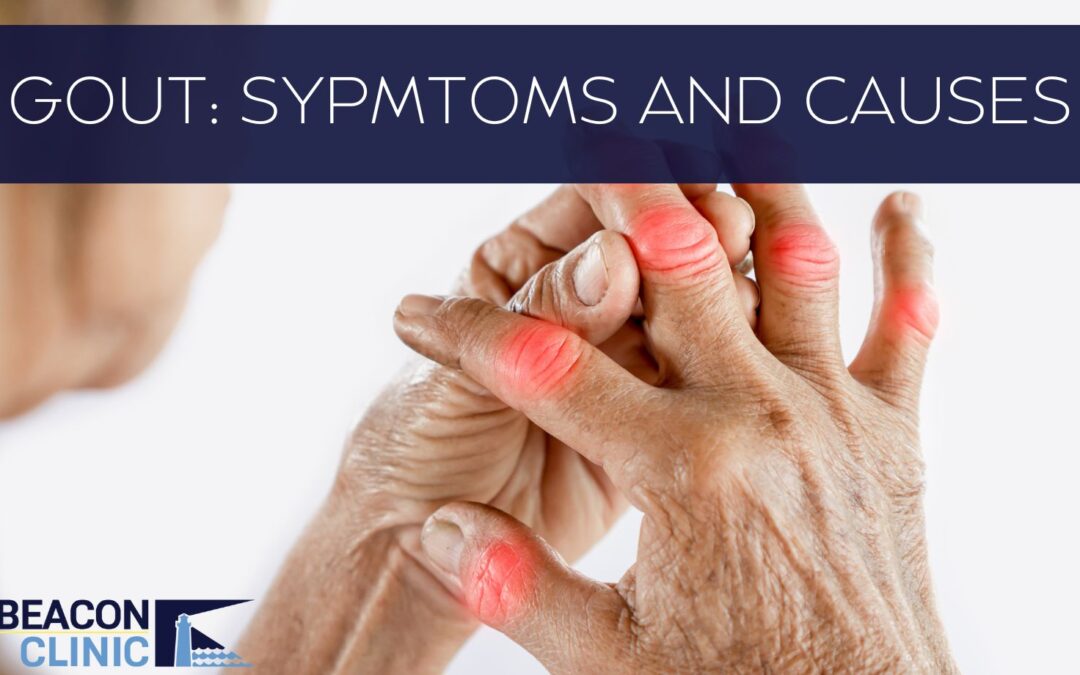 Gout Symptoms: Spot the Signs Before Pain Strikes