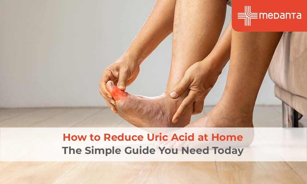 How to Cure Uric Acid Permanently – Simple Steps
