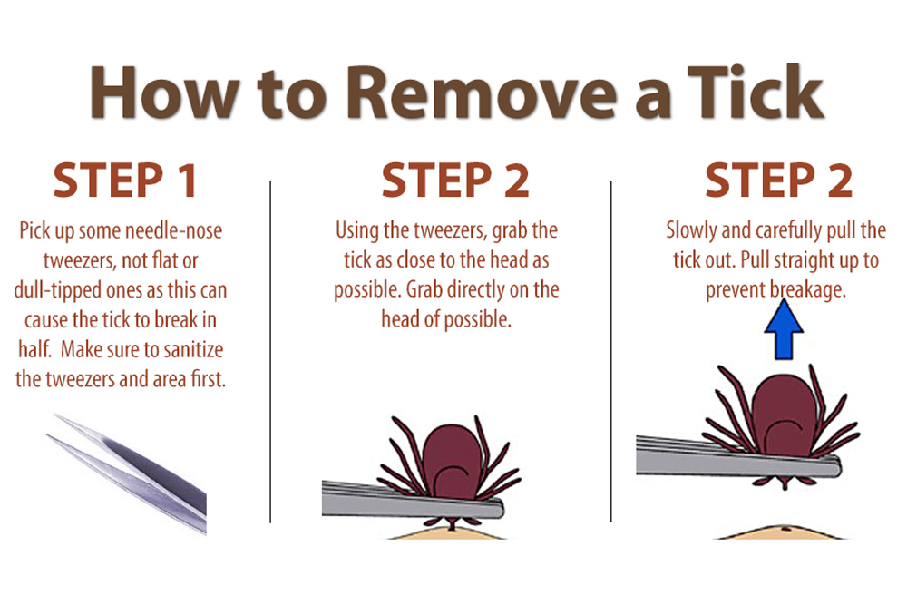 How to Remove a Tick – Safe Steps for People & Pets