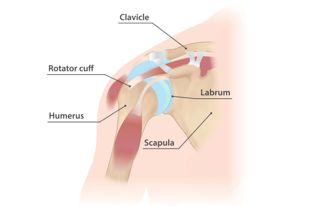 Hypermobile Shoulder: Quick Answers & Practical Tips