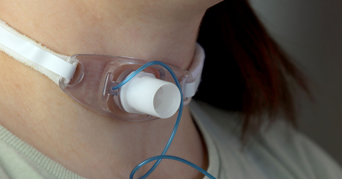 Living with Tracheostomy: Real‑World Tips & Care Guide