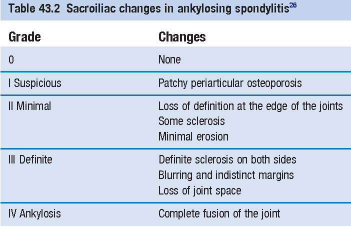 Modified New York Criteria for Ankylosing Spondylitis