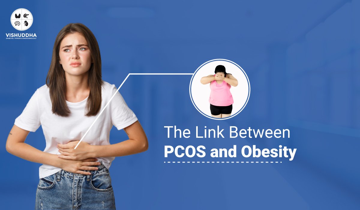 Obesity PCOS Link: What You Need to Know Today