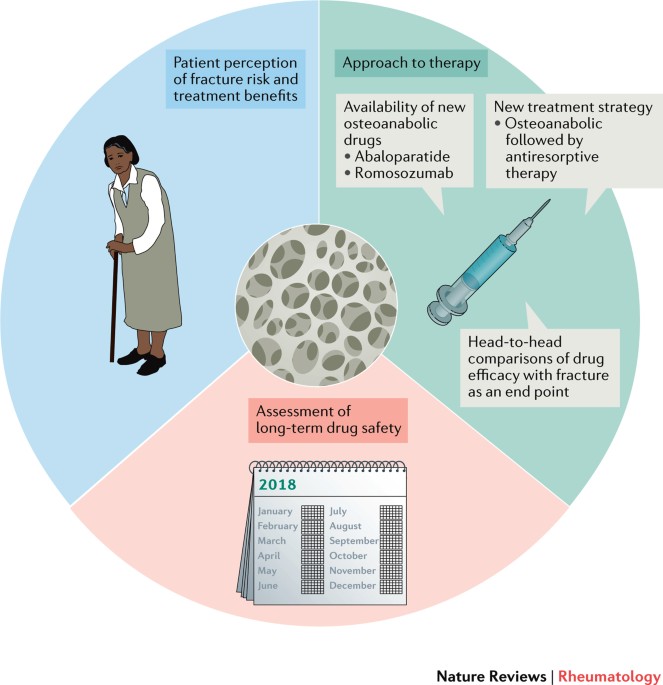 Osteoporosis Treatment: Options, Risks & Best Choice