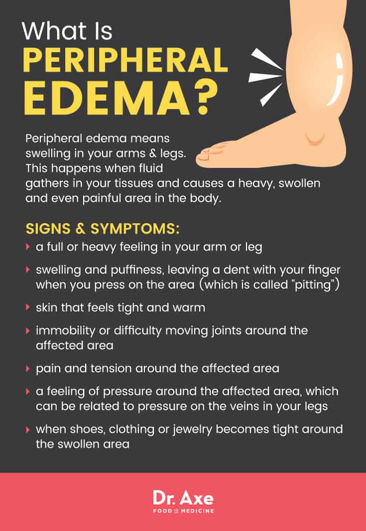 Peripheral Edema Causes: Why Your Legs Feel Swollen