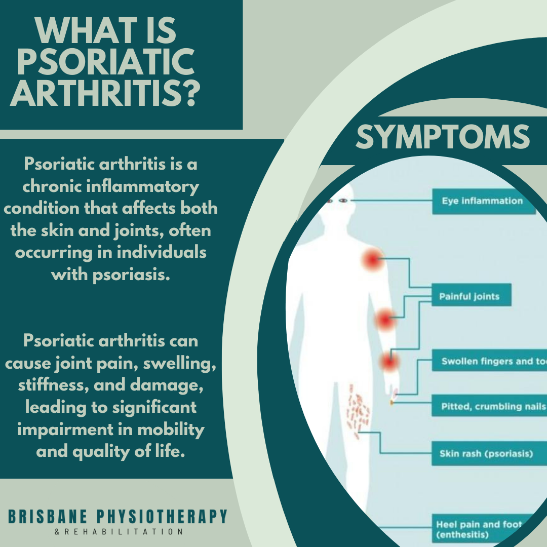 Psoriatic Arthritis Therapy: Options & Guidance
