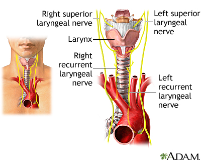 Recurrent Laryngeal Nerve Paralysis: Essential Facts