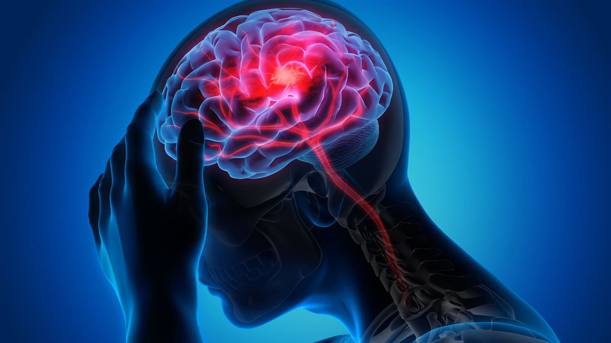 Repetitive Head Trauma: Risks, Symptoms, and CTE Insight