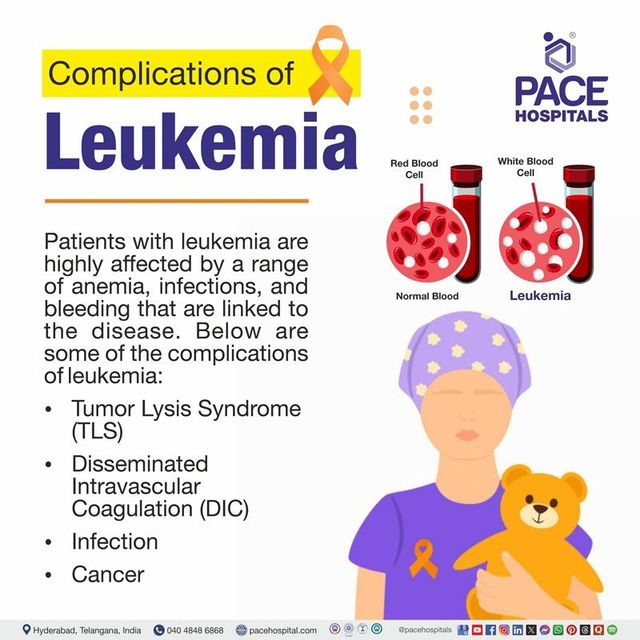 Serious Complication of Leukemia: What You Must Know