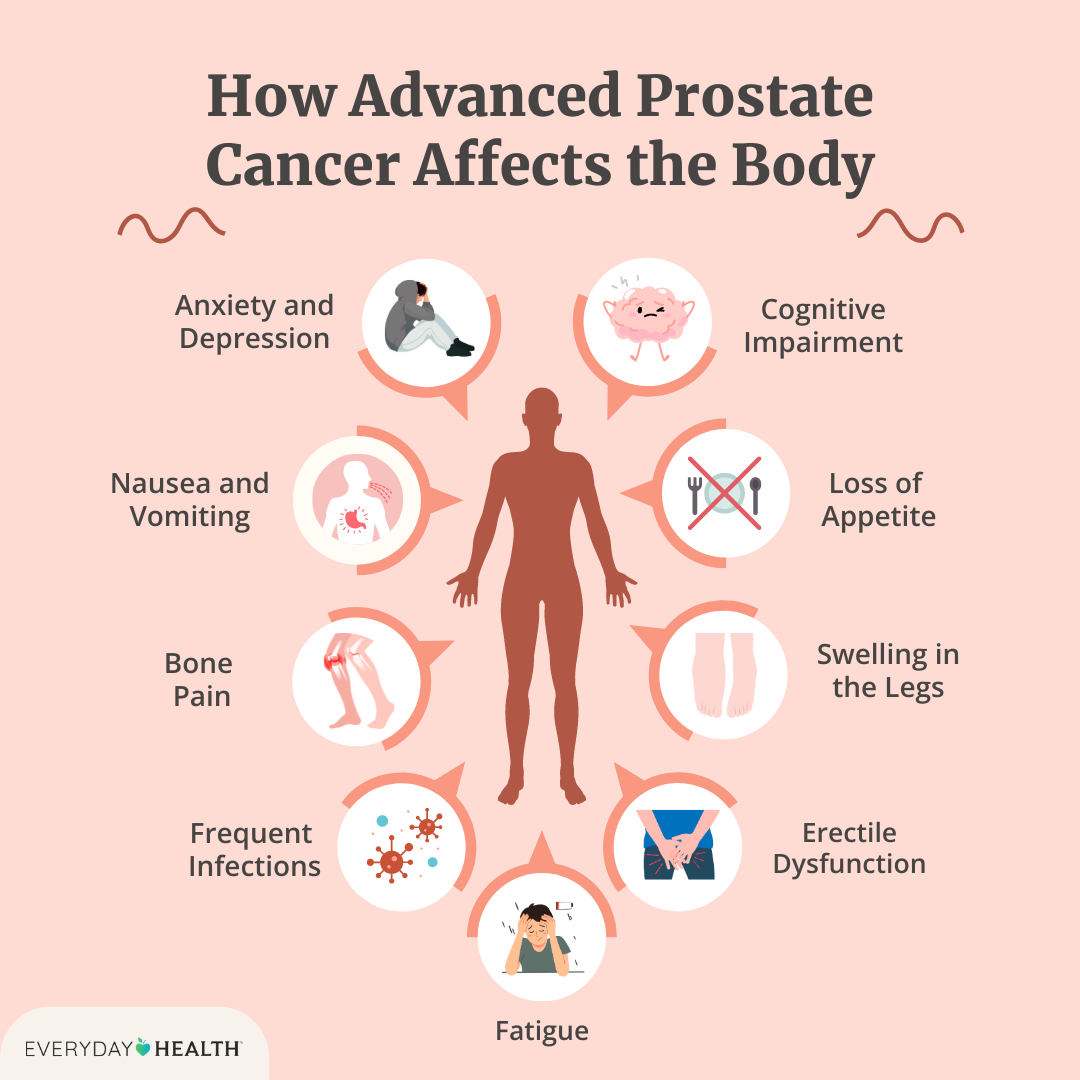 Understanding Side Effects of Prostate Cancer Treatment
