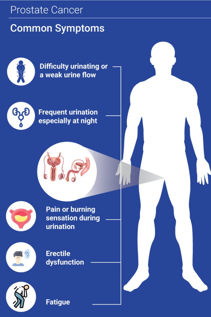 Stage 1 Prostate Cancer Symptoms – What to Watch For