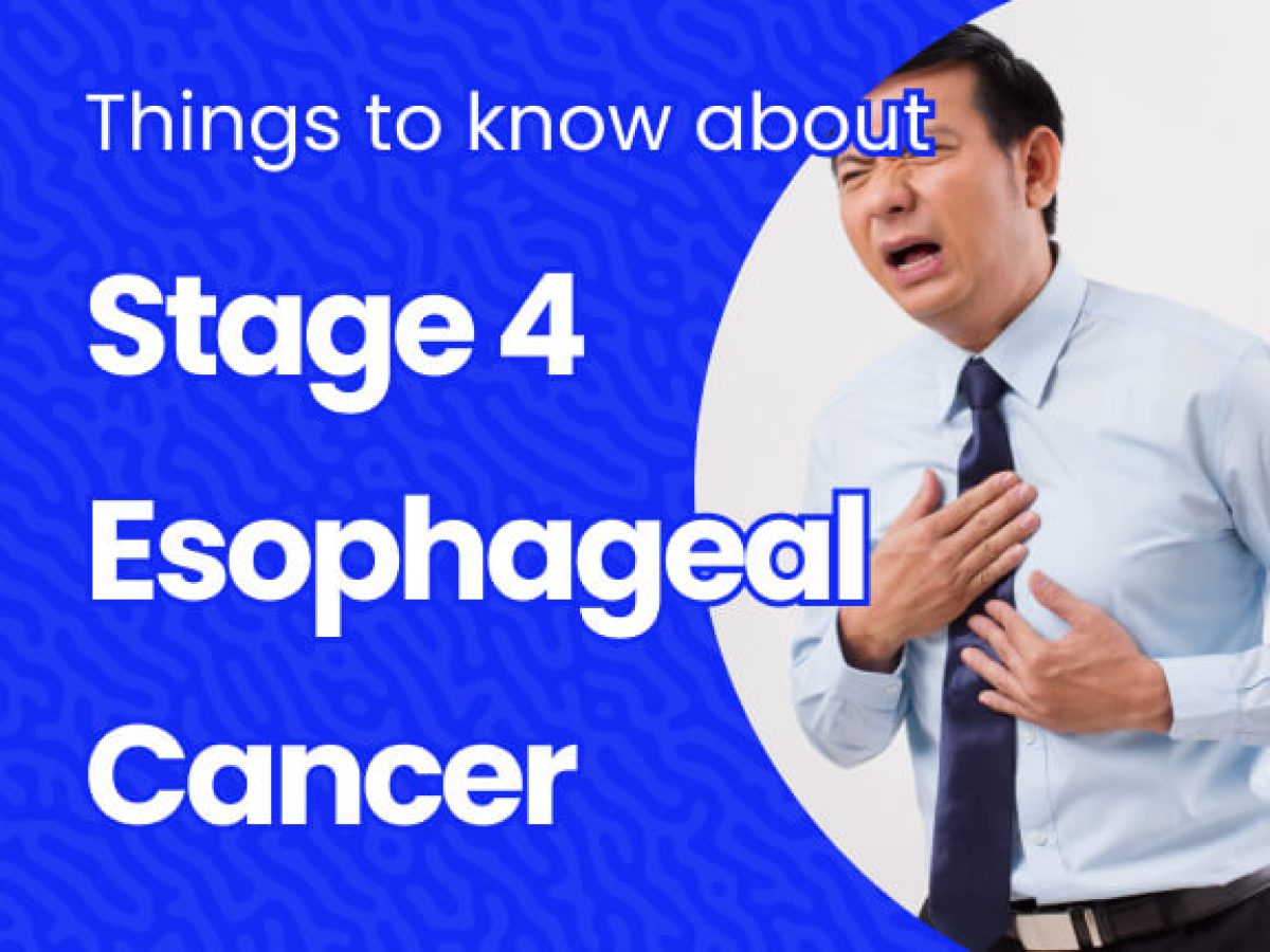 Stage 4 Esophageal Cancer: Key Facts & Outlook