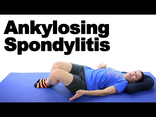 Ankylosing Spondylitis Stretching: 6 Simple Daily Moves