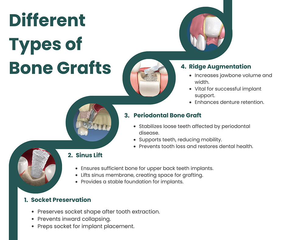 Bone Graft Types: A Practical Guide for Patients