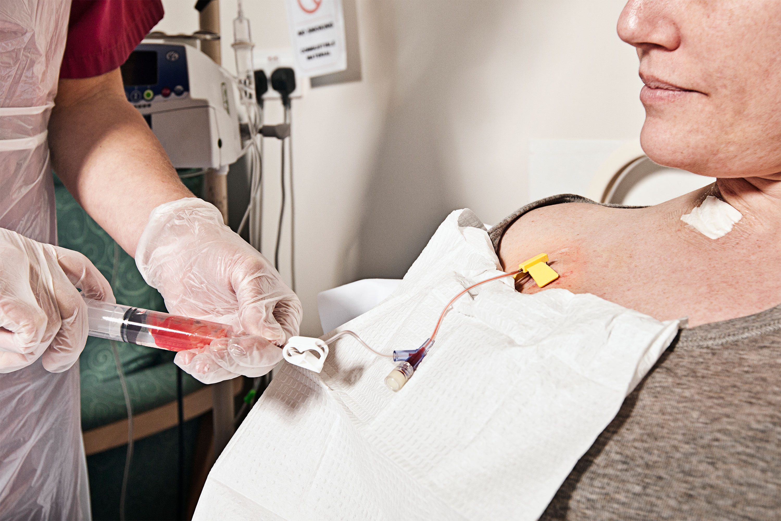 Breast Cancer Chemotherapy: What You Need to Know