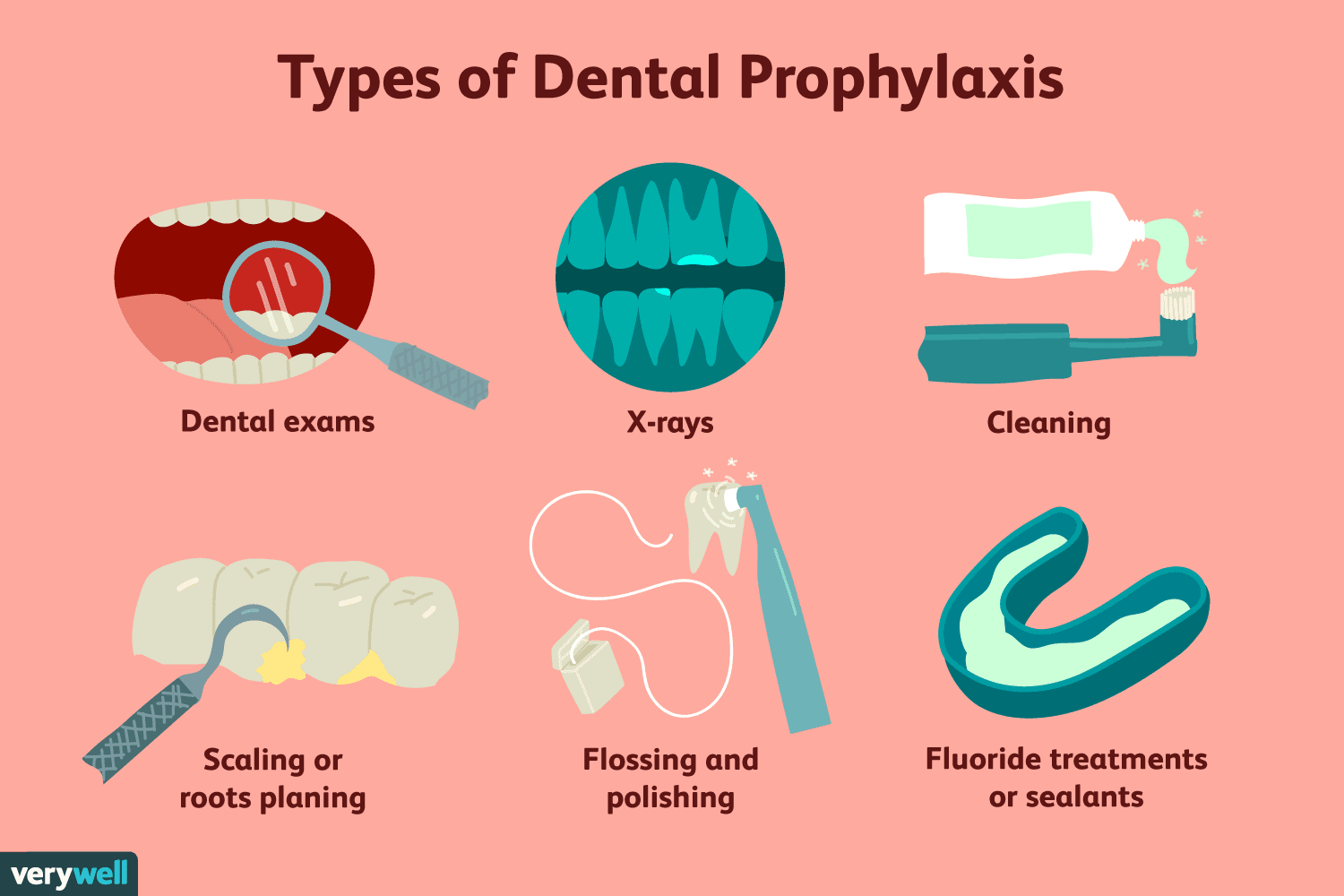 Dental Prophylaxis: When Antibiotics Truly Matter