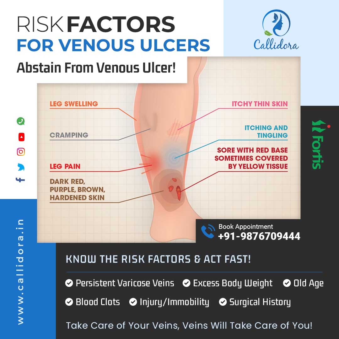 Understanding Leg Ulcer Risk: What You Need to Know