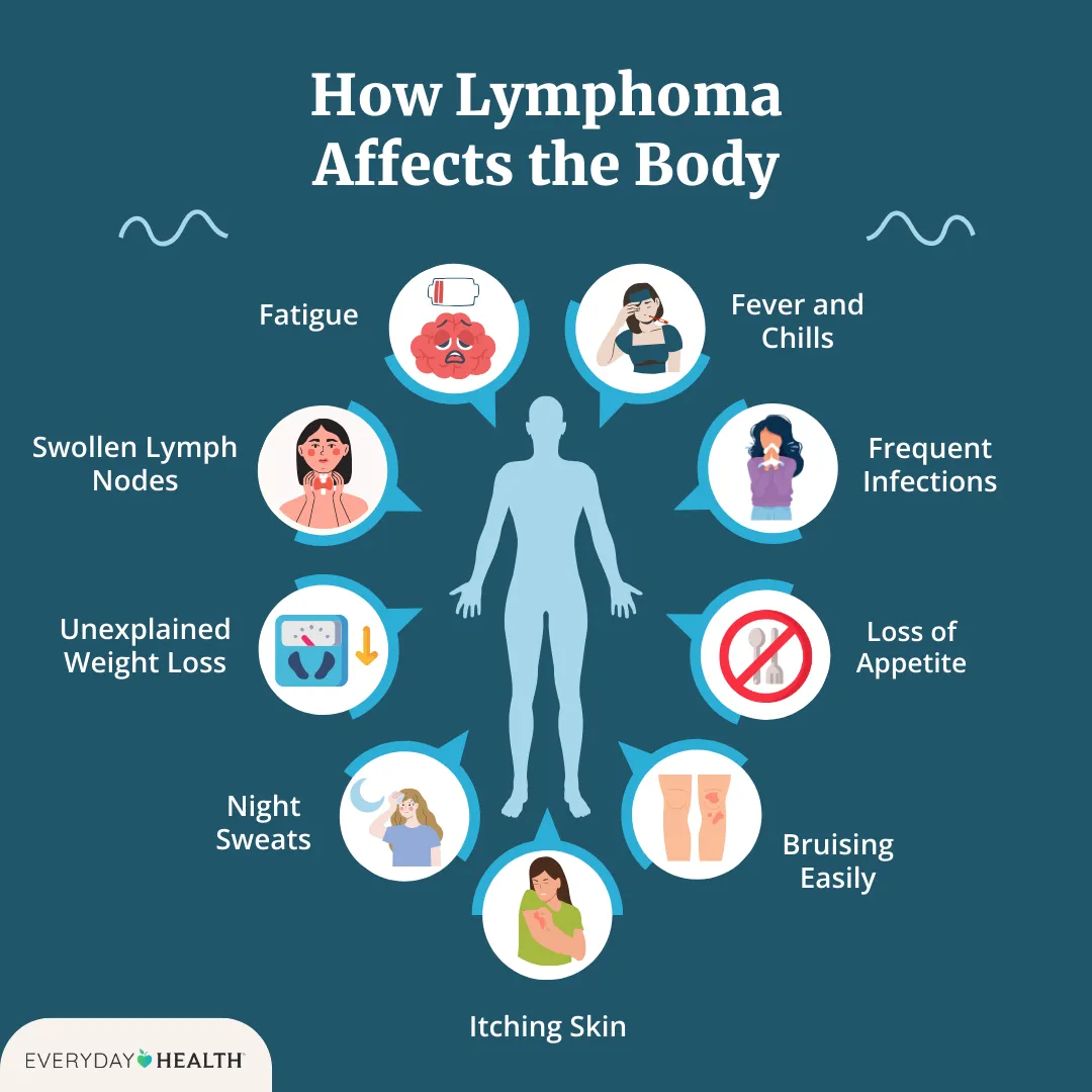 Lymphoma Signs: What to Look for and When to Act